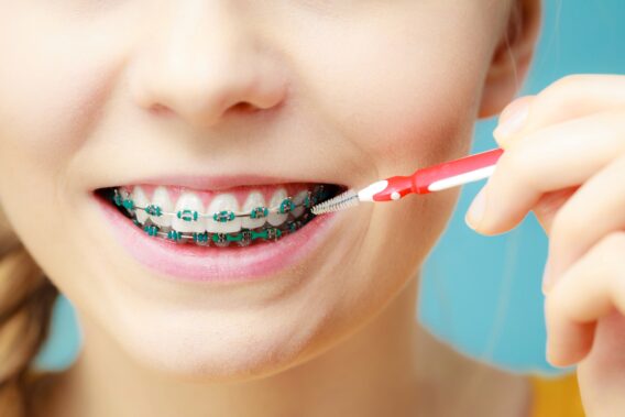 Dental Clinics - Blog tanden stokeren en ragen – Dental Clinics-min