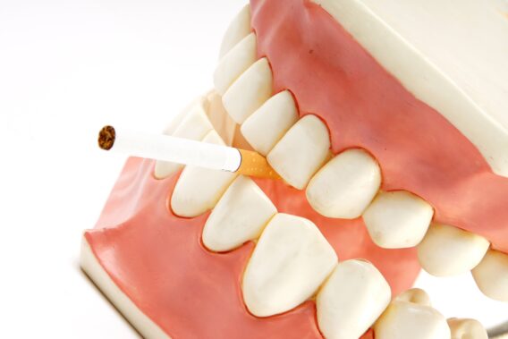 Roken & het gebit - Dental Clinics