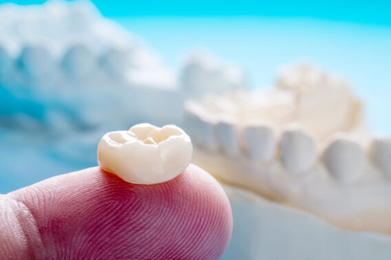 Dental Clinics - Kronen tandarts – Dental Clinics