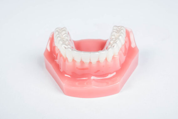 Dental Clinics - Onzichtbare beugel – Dental Clinics