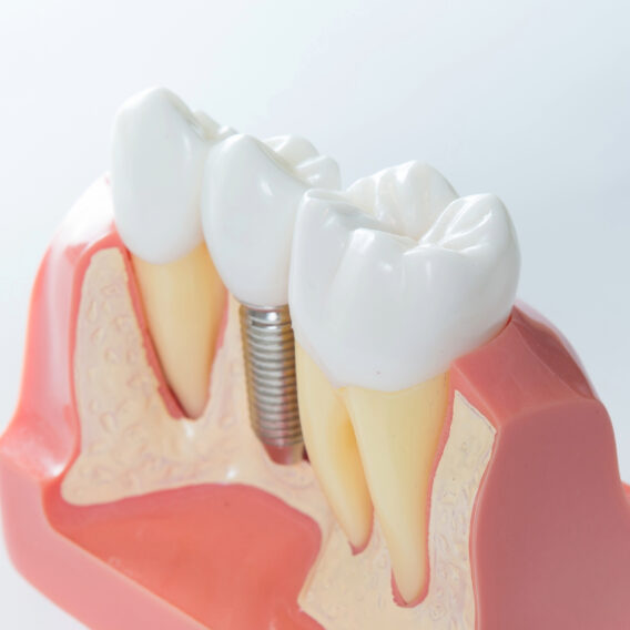 Dental Clinics - Implantologie – Dental Clinics